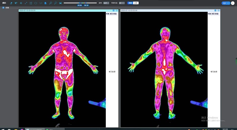 疫情环境下，为什么红外热成像产品要比额温枪有效率？